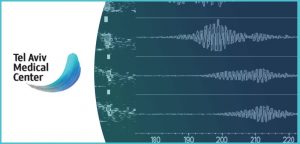 בדיקת MES – Microembolic Signal