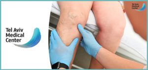 ורידים ברגליים