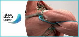 מחלות שרירים