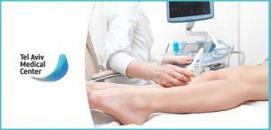 דופלר ורידי רגליים